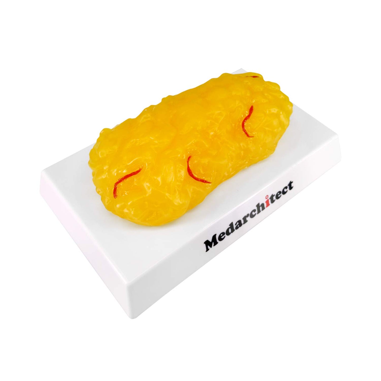 Authentic Human Body Fat Replica with Red Veins - 1 lb, Keep Fit & Weight Loss Motivation & Reminder, Human Fatty Tissue Demonstration Model