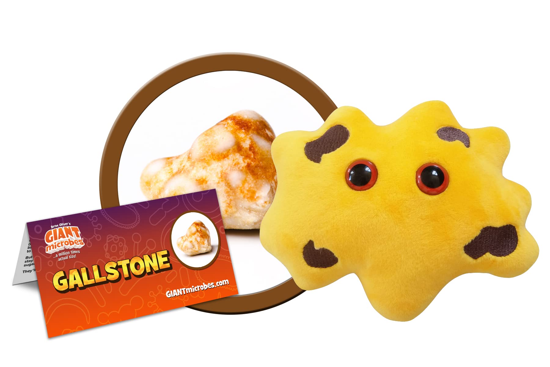 GIANTmicrobes Gallstone Plush, gallstones, Gallbladder Plush, gallstones Removal Surgery Gifts, laparoscopic Gifts, cholecystectomy Gifts