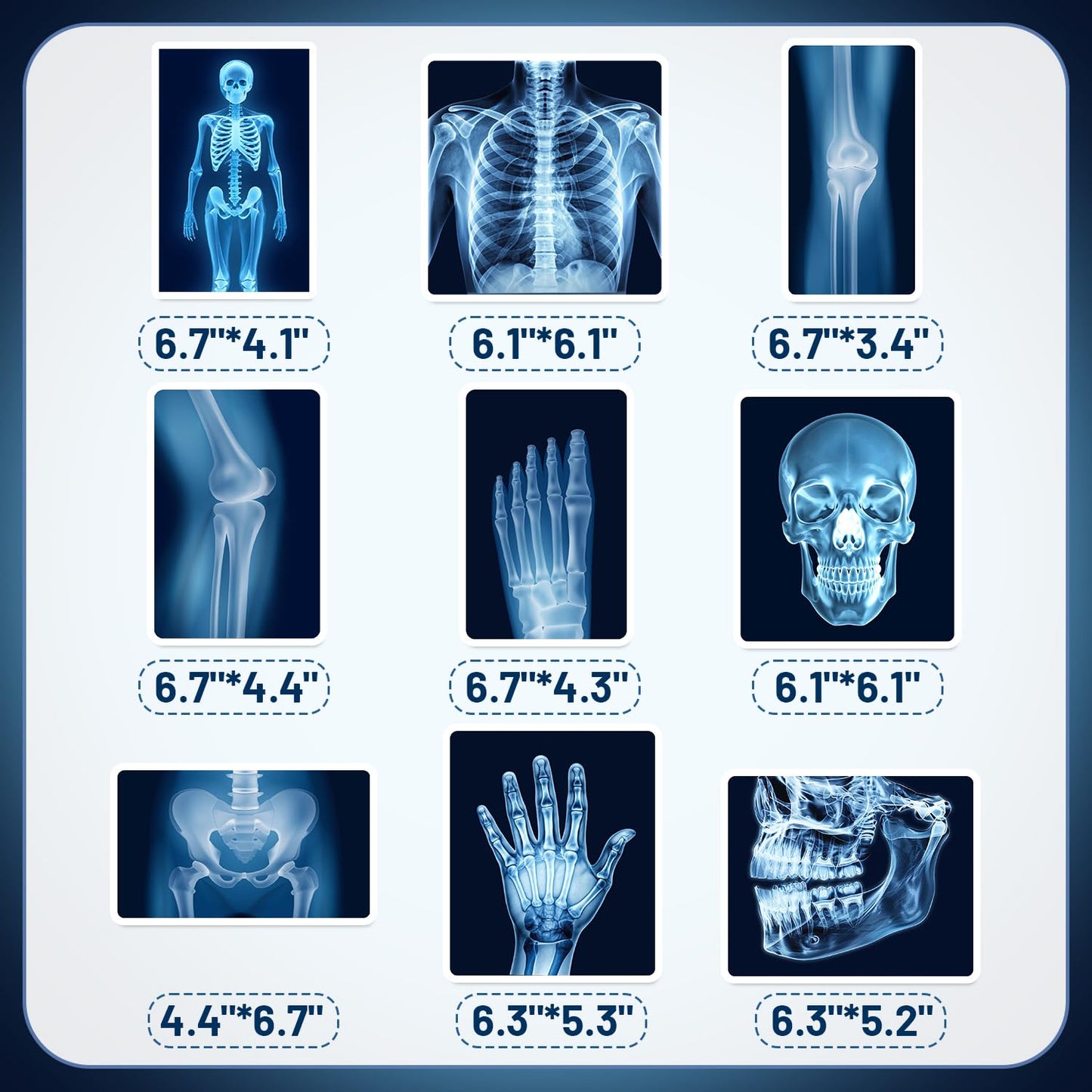 9Pcs Radiology X Ray Honeycomb Centerpieces Radiology Party Favors Birthday Party Decorations X Ray Centerpieces Decorations Supplies for Radiology