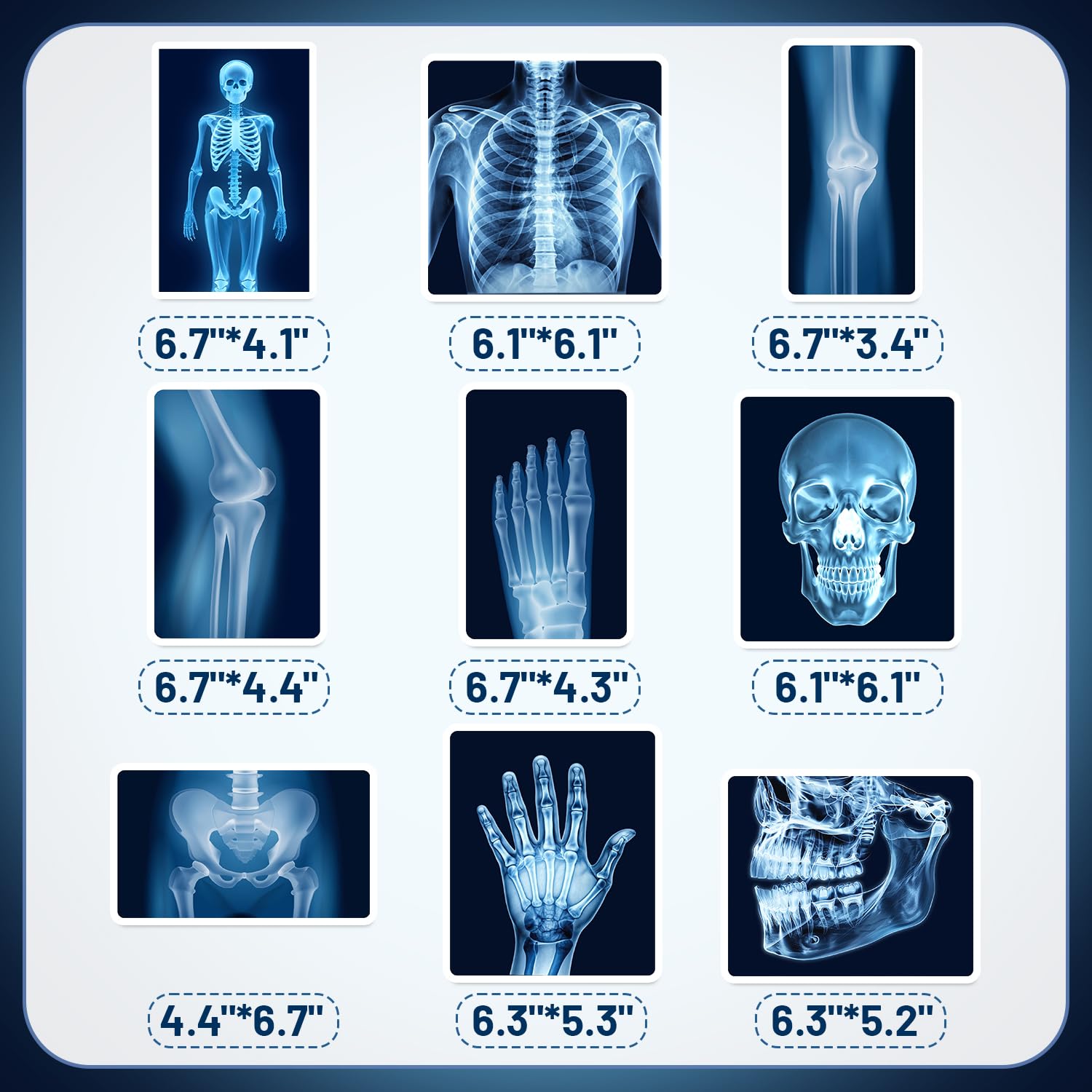 9Pcs Radiology X Ray Honeycomb Centerpieces Radiology Party Favors Birthday Party Decorations X Ray Centerpieces Decorations Supplies for Radiology