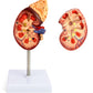 QWORK Life-Size Human Kidney Model, Educational Anatomy Replica Two-Part Structure Teaching Tool for Classroom and Biology Study