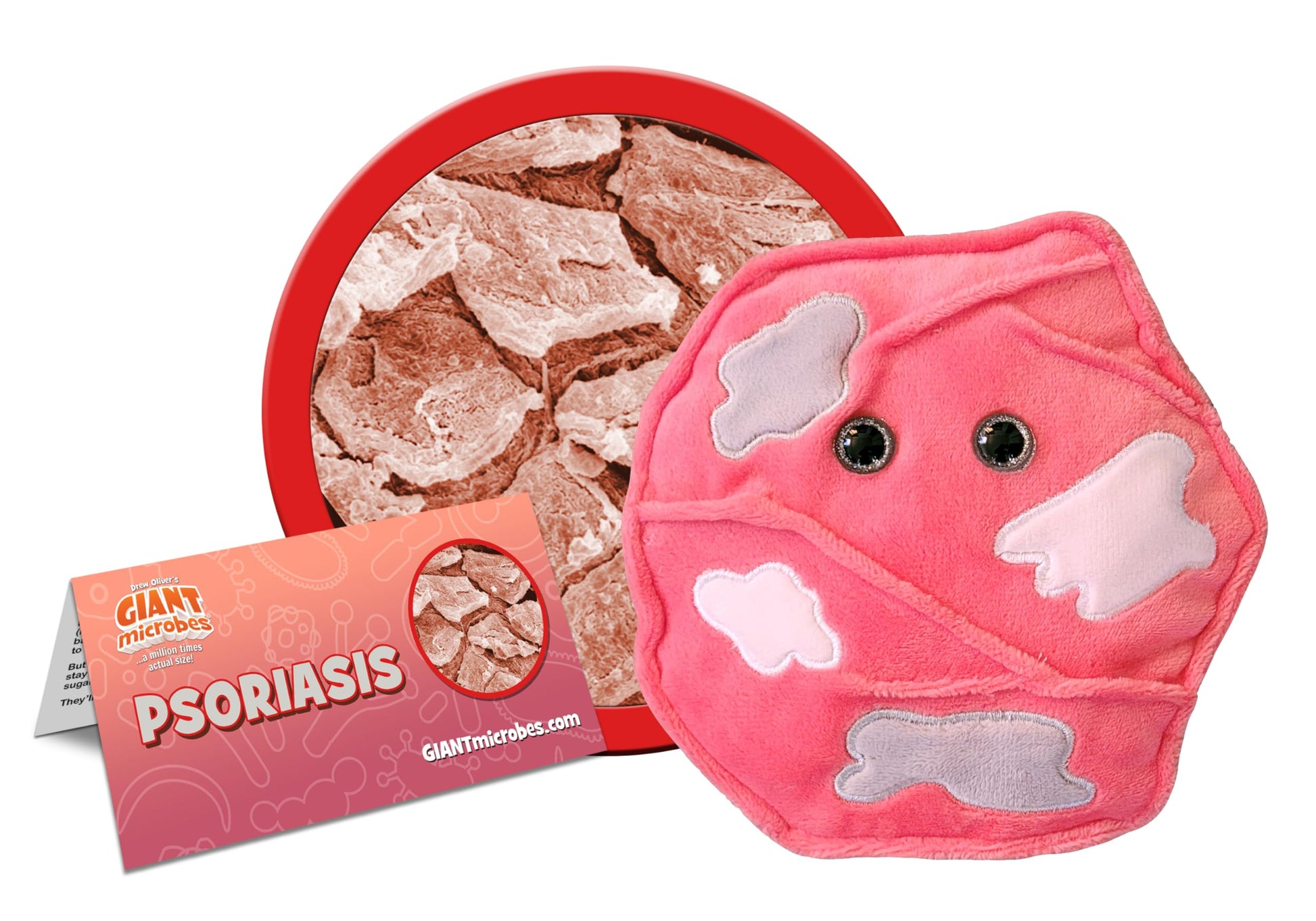 GIANT MICROBES Psoriasis Plush, Dermatology Gifts, Autoimmune Disease Gifts, Skin Health, Rheumatologist Gift, Skin Cells, Dermatologist Gift