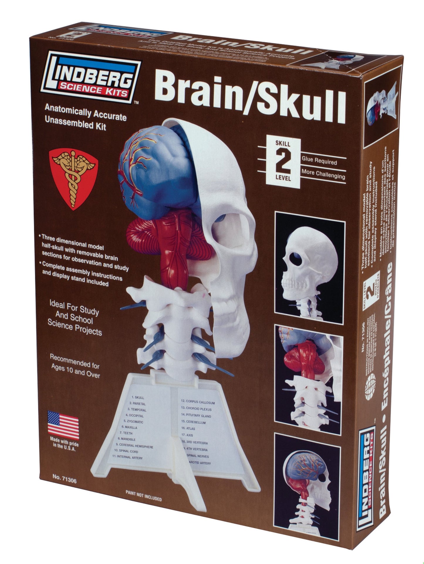 Lindberg Brain and Skull Half