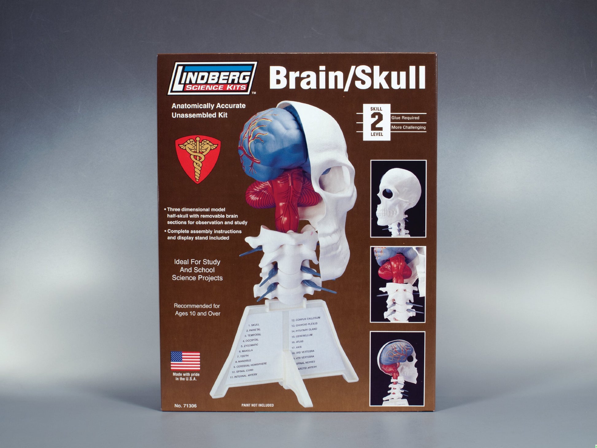 Lindberg Brain and Skull Half